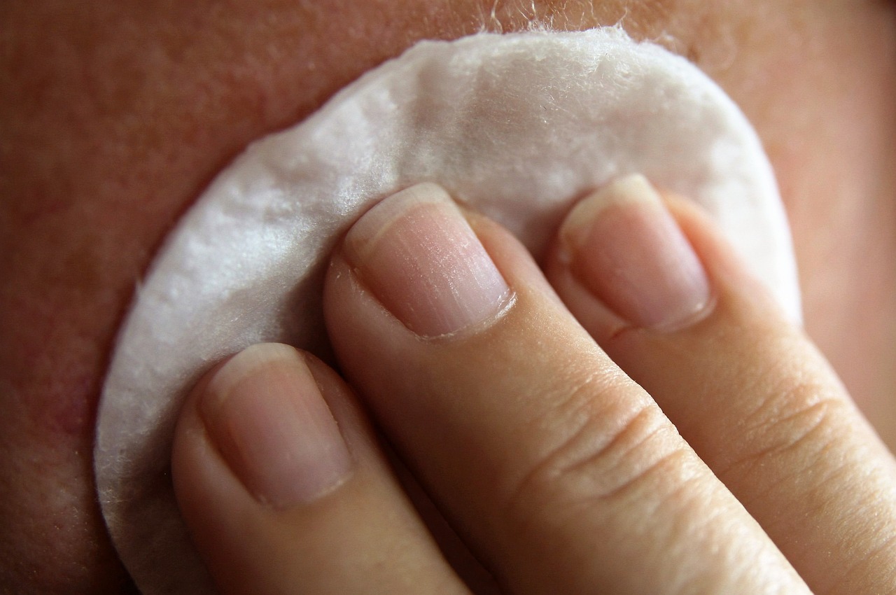 ¿Cómo eliminar rápido el acné facial?